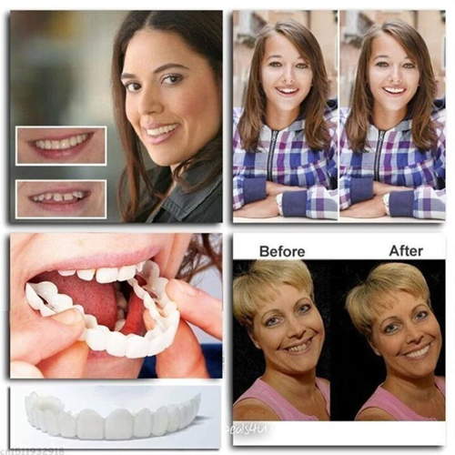 Adjustable Snap-On Dentures