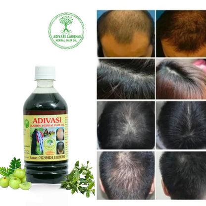 ADIVASI HERBAL NILAMBARI HAIR OIL! PACK OF 2 (BUY 1 GET 1 FREE)