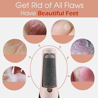 Electric Foot Callus Remover