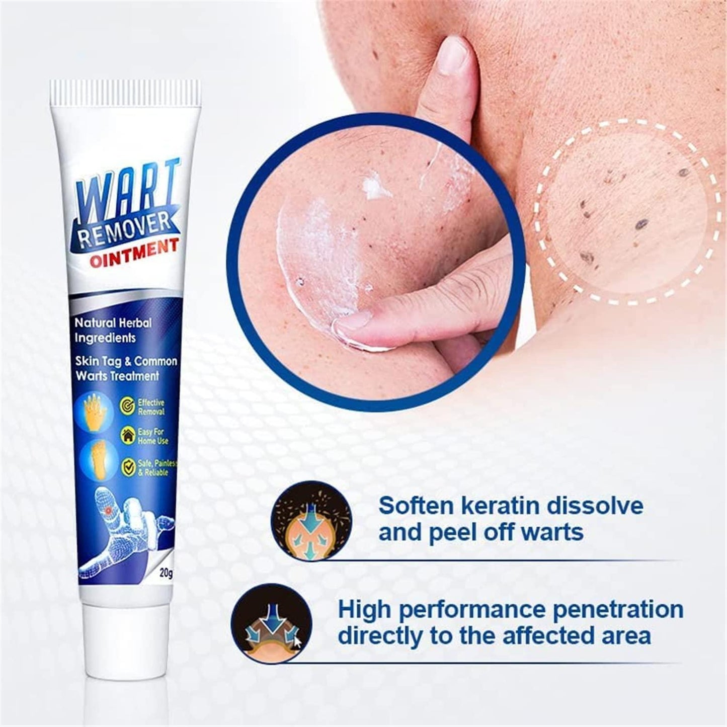 WartsOff Instant Blemish Removal Cream