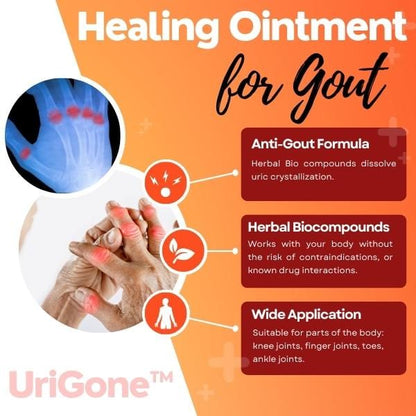 70% OFF Gout Removal Ointment - Now in India (4.9 ⭐⭐⭐⭐⭐ Reviews)