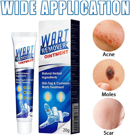 Wart Remover Ice Cream Mask